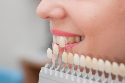 Причины желтых зубов и способы их отбеливания