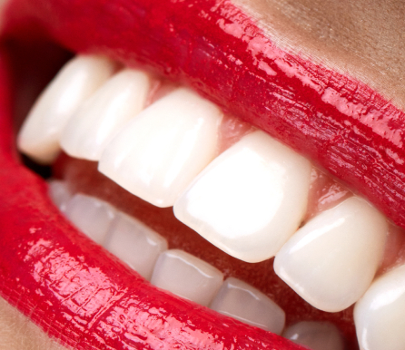 Комплексная гигиена и отбеливание зубов
